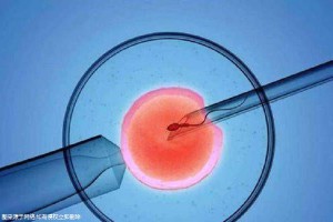 专业同志代怀服务收费标准